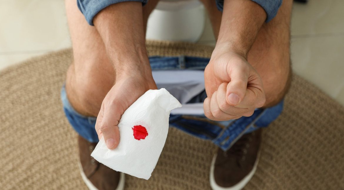 кров з заднього проходу після випорожнення